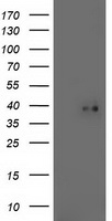 HEK293T cells were transfected with the pCMV6-ENTRY control (Left lane) or pCMV6-ENTRY TOMM34 (Right lane) cDNA for 48 hrs and lysed. Equivalent amounts of cell lysates (5 ug per lane) were separated by SDS-PAGE and immunoblotted with anti-TOMM34.