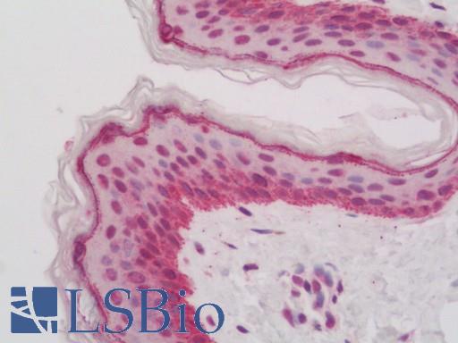 Human Skin: Formalin-Fixed, Paraffin-Embedded (FFPE)