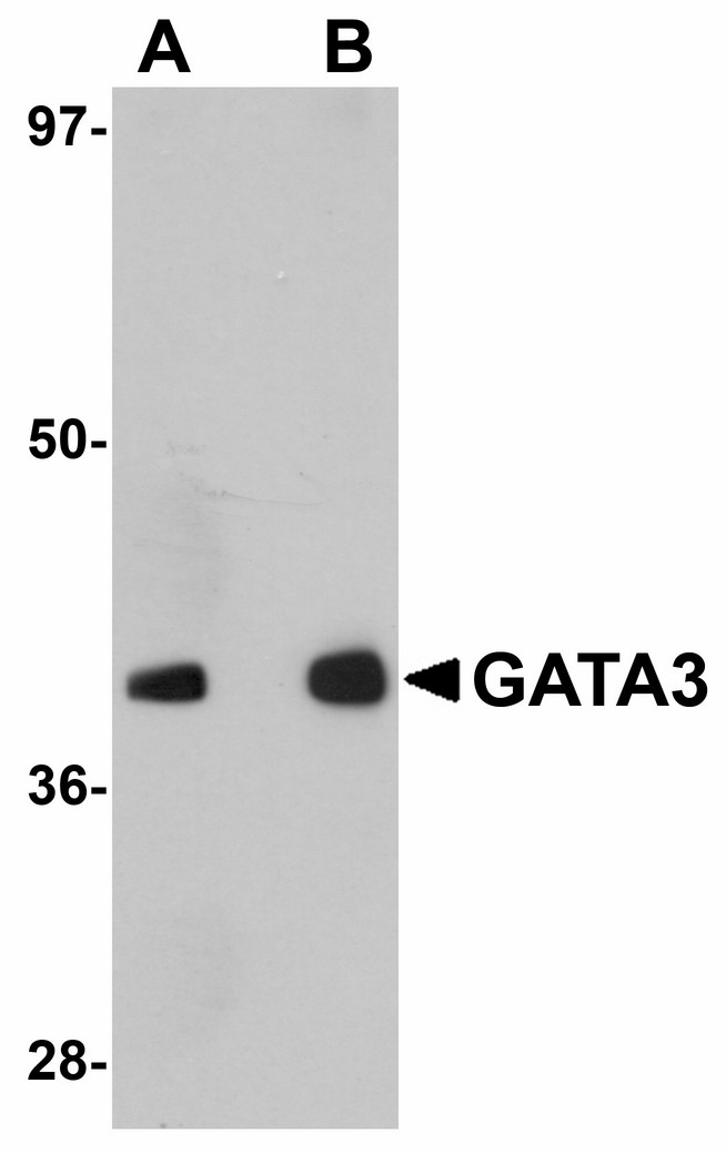 Western blot of GATA3 in human brain tissue lysate with GATA3 antibody at (A) 1 and (B) 2 ug/ml.