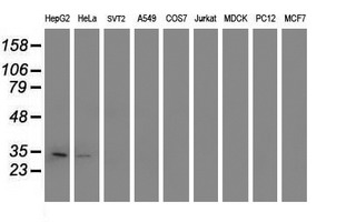 Western blot of extracts (35ug) from 9 different cell lines by using anti-TOMM34 monoclonal antibody.