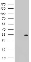 HEK293T cells were transfected with the pCMV6-ENTRY control (Left lane) or pCMV6-ENTRY TOMM34 (Right lane) cDNA for 48 hrs and lysed. Equivalent amounts of cell lysates (5 ug per lane) were separated by SDS-PAGE and immunoblotted with anti-TOMM34.