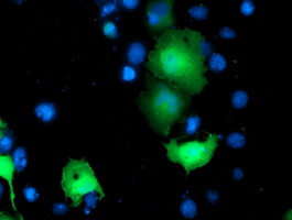 Anti-TOMM34 mouse monoclonal antibody immunofluorescent staining of COS7 cells transiently transfected by pCMV6-ENTRY TOMM34.