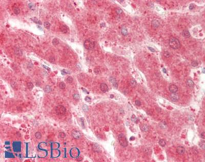 Human Liver: Formalin-Fixed, Paraffin-Embedded (FFPE)