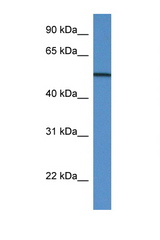 GC / VDBP antibody eestern blot of Placenta lysate. Antibody concentration 1 ug/ml.