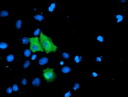 Anti-TOMM34 mouse monoclonal antibody immunofluorescent staining of COS7 cells transiently transfected by pCMV6-ENTRY TOMM34.