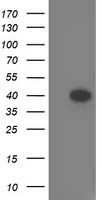 HEK293T cells were transfected with the pCMV6-ENTRY control (Left lane) or pCMV6-ENTRY TOMM34 (Right lane) cDNA for 48 hrs and lysed. Equivalent amounts of cell lysates (5 ug per lane) were separated by SDS-PAGE and immunoblotted with anti-TOMM34.