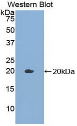Western blot of recombinant GDF10 / BIP.