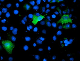 Anti-TOMM34 mouse monoclonal antibody immunofluorescent staining of COS7 cells transiently transfected by pCMV6-ENTRY TOMM34.
