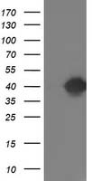 HEK293T cells were transfected with the pCMV6-ENTRY control (Left lane) or pCMV6-ENTRY TOMM34 (Right lane) cDNA for 48 hrs and lysed. Equivalent amounts of cell lysates (5 ug per lane) were separated by SDS-PAGE and immunoblotted with anti-TOMM34.