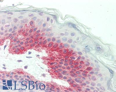 Human Skin: Formalin-Fixed, Paraffin-Embedded (FFPE)