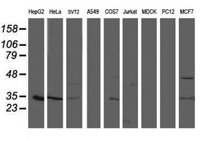 Western blot of extracts (35 ug) from 9 different cell lines by using anti-TOMM34 monoclonal antibody.