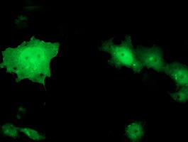 Anti-TOMM34 mouse monoclonal antibody immunofluorescent staining of COS7 cells transiently transfected by pCMV6-ENTRY TOMM34.