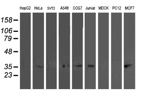 Western blot of extracts (35 ug) from 9 different cell lines by using anti-TOMM34 monoclonal antibody.