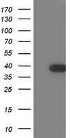 HEK293T cells were transfected with the pCMV6-ENTRY control (Left lane) or pCMV6-ENTRY TOMM34 (Right lane) cDNA for 48 hrs and lysed. Equivalent amounts of cell lysates (5 ug per lane) were separated by SDS-PAGE and immunoblotted with anti-TOMM34.