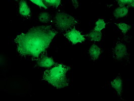 Anti-TOMM34 mouse monoclonal antibody immunofluorescent staining of COS7 cells transiently transfected by pCMV6-ENTRY TOMM34.
