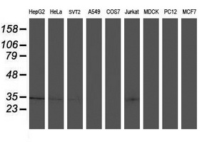 Western blot of extracts (35 ug) from 9 different cell lines by using anti-TOMM34 monoclonal antibody.
