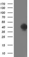 HEK293T cells were transfected with the pCMV6-ENTRY control (Left lane) or pCMV6-ENTRY TOMM34 (Right lane) cDNA for 48 hrs and lysed. Equivalent amounts of cell lysates (5 ug per lane) were separated by SDS-PAGE and immunoblotted with anti-TOMM34.