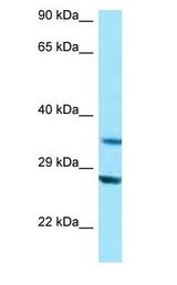 TOMM34 antibody Western Blot of 721_B.