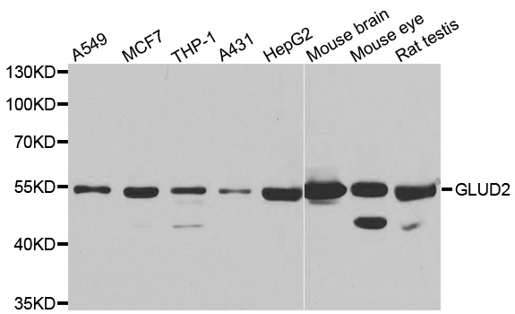 Western blot analysis of extracts of various cell lines, using GLUD2 antibody.