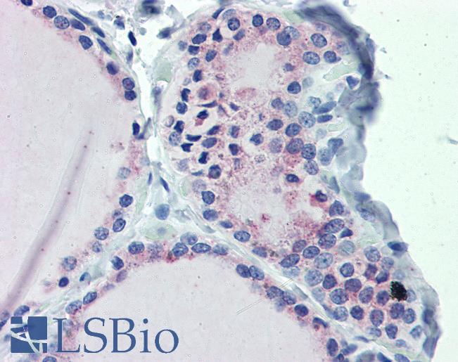 Anti-GNAS antibody IHC of human thyroid. Immunohistochemistry of formalin-fixed, paraffin-embedded tissue after heat-induced antigen retrieval. Antibody LS-B4007 concentration 5 ug/ml.