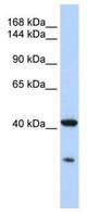 Western blot of MCF7 cell lysate.