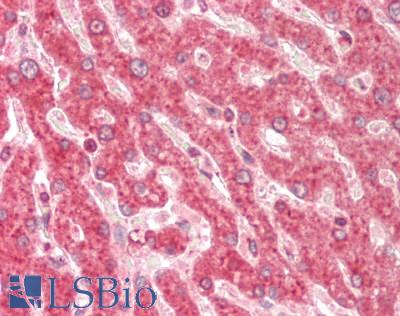 Human Liver: Formalin-Fixed, Paraffin-Embedded (FFPE)