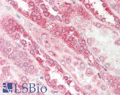 Human Kidney: Formalin-Fixed, Paraffin-Embedded (FFPE)