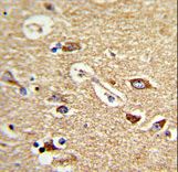 Formalin-fixed and paraffin-embedded human brain tissue reacted with TOMM70A Antibody , which was peroxidase-conjugated to the secondary antibody, followed by DAB staining. This data demonstrates the use of this antibody for immunohistochemistry; clinical relevance has not been evaluated.