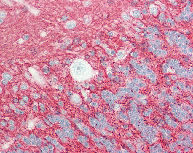 Human Brain, Cerebellum: Formalin-Fixed, Paraffin-Embedded (FFPE)