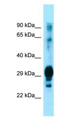 GPM6A / M6A antibody Western Blot of Human brain.