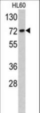 Western blot of TOMM70A antibody in HL60 cell line lysates (35 ug/lane). TOMM70A (arrow) was detected using the purified antibody.