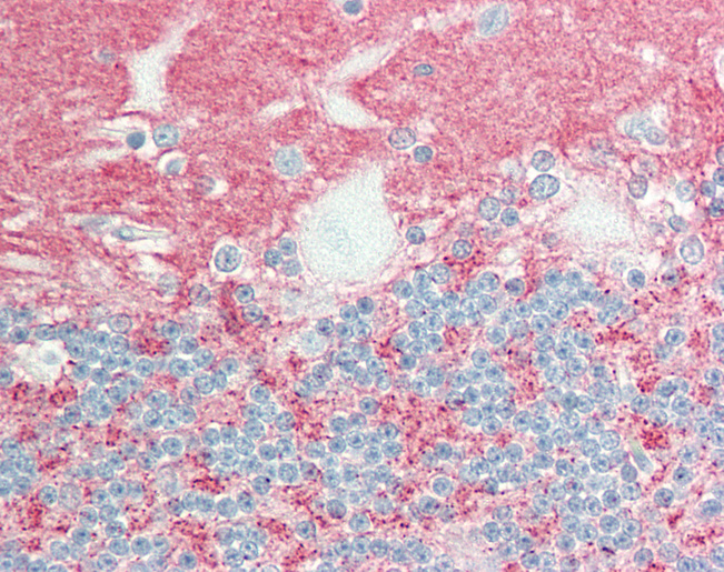 Human Brain, Cerebellum: Formalin-Fixed, Paraffin-Embedded (FFPE)