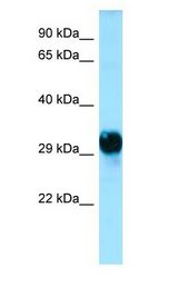 GPM6A / M6A antibody Western Blot of Human brain.