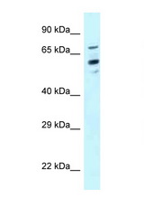 TOMM70A antibody LS-C145680 Western blot of HeLa Cell lysate. Antibody concentration 1 ug/ml.