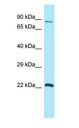 AGS3 antibody Western Blot of NCI-H226.