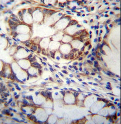 GPSM1 Antibody immunohistochemistry of formalin-fixed and paraffin-embedded human rectum tissue followed by peroxidase-conjugated secondary antibody and DAB staining.