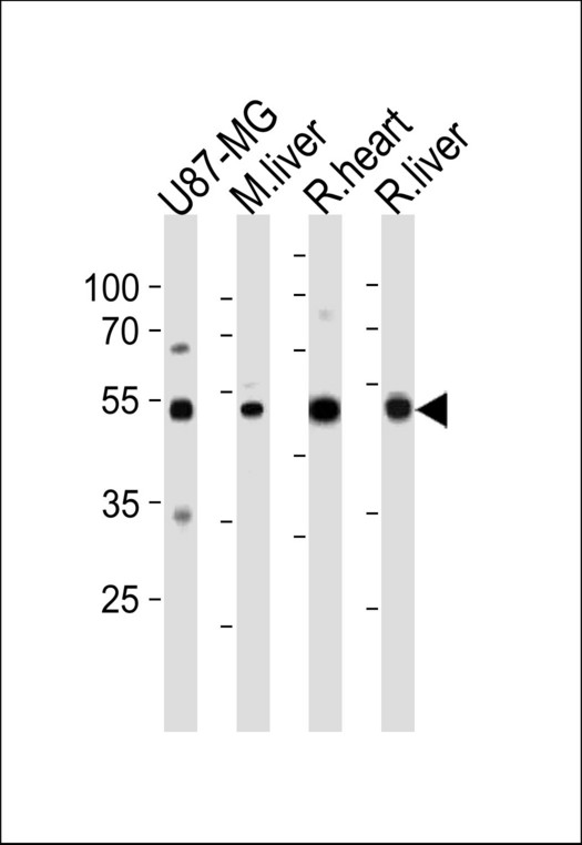 GPT Antibody (N-term R133) western blot of U87-MG cell line , mouse liver ,and rat heart and liver tissue lysates (35 ug/lane). The GPT antibody detected the GPT protein (arrow).