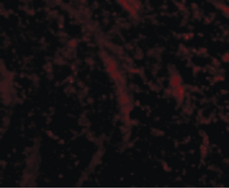 Immunofluorescence of TOM70 in Mouse Brain cells with TOM70 antibody at 5 ug/ml.