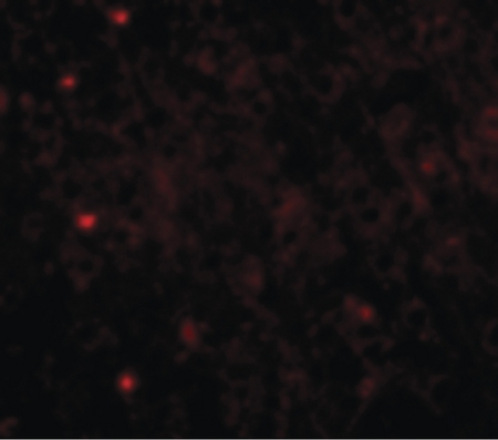 Immunofluorescence of TOM70 in Mouse Brain cells with TOM70 antibody at 20 ug/ml.
