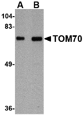 Western blot of TOM70 in rat brain tissue lysate with TOM70 antibody at (A) 1 and (B) 2 ug/ml