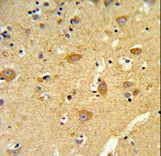 Formalin-fixed and paraffin-embedded human brain tissue reacted with TOMM70A Antibody , which was peroxidase-conjugated to the secondary antibody, followed by DAB staining. This data demonstrates the use of this antibody for immunohistochemistry; clinical relevance has not been evaluated.