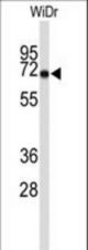 Western blot of TOMM70A Antibody in WiDr cell line lysates (35 ug/lane). TOMM70A (arrow) was detected using the purified antibody.