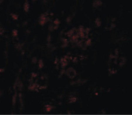 Immunofluorescence of PION in Human Brain cells with PION antibody at 20 ug/ml.
