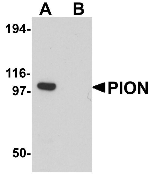 Western blot analysis of PION in EL4 cell lysate with PION antibody at 0.25 ug/ml in (A) the absence and (B) the presence of blocking peptide.