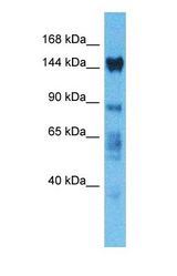 Western blot of TONSL Antibody with human 293T Whole Cell lysate.