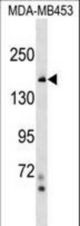 NFKBIL2 Antibody western blot of MDA-MB453 cell line lysates (35 ug/lane). The NFKBIL2 antibody detected the NFKBIL2 protein (arrow).