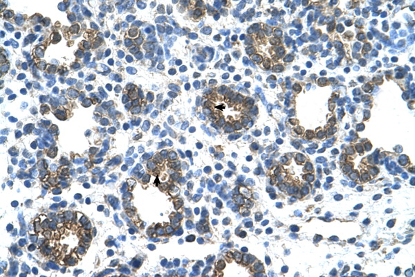 GUSB antibody LS-C40459 IHC of formalin-fixed, paraffin-embedded human Lung. Positive label: Alveolar cells indicated with arrows. Antibody concentration 4-8 ug/ml. Magnification 400X.