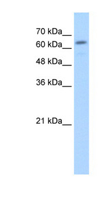 GUSB antibody LS-C40459 Western blot of HepG2 cell lysate.