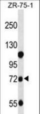 GUSB Antibody western blot of ZR-75-1 cell line lysates (35 ug/lane). The GUSB antibody detected the GUSB protein (arrow).