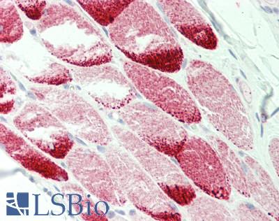 Human Tonsil, Sketetal Myocytes: Formalin-Fixed, Paraffin-Embedded (FFPE)